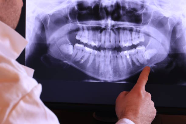 Best Emergency Denture Repair in New Hampton, IA